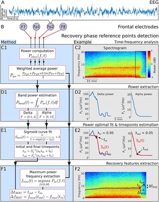 Spectral EEG correlations from the different phases of general anesthesia